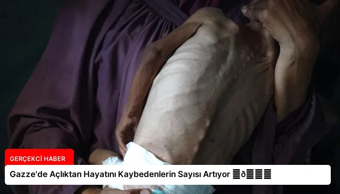 Gazze’de Açlıktan Hayatını Kaybedenlerin Sayısı Artıyor ⏬👇