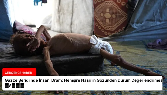 Gazze Şeridi’nde İnsani Dram: Hemşire Nasır’ın Gözünden Durum Değerlendirmesi ⏬👇