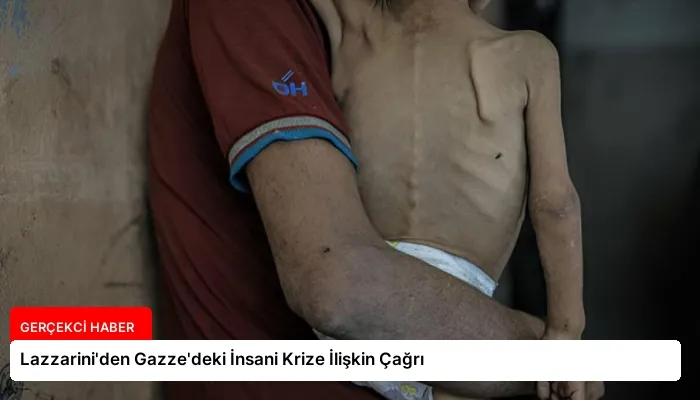 Lazzarini’den Gazze’deki İnsani Krize İlişkin Çağrı