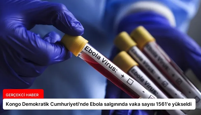 Kongo Demokratik Cumhuriyeti’nde Ebola salgınında vaka sayısı 1561’e yükseldi